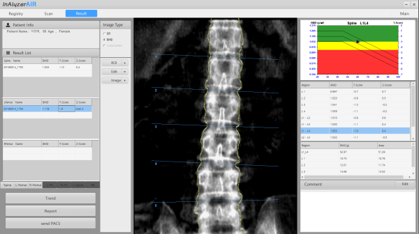 Bone Densitometer Medikors InAlyzer Air – Bild 9