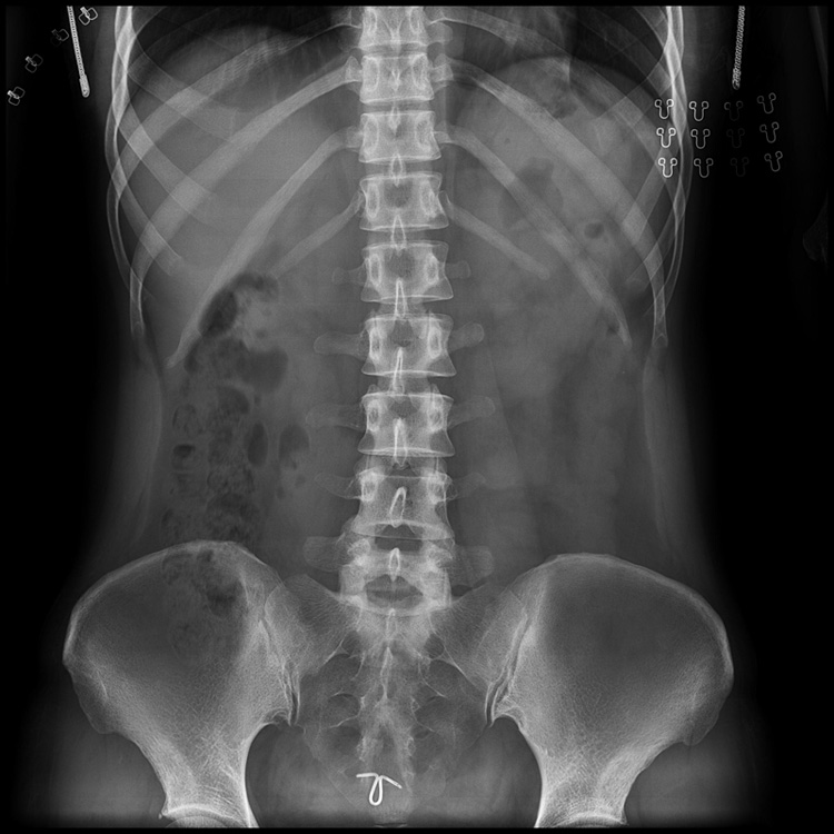 Flat Panel Detector Careray 1717 wireless - Image 10