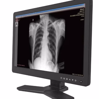 Reshin MD26C – Medizinischer Befundmonitor
