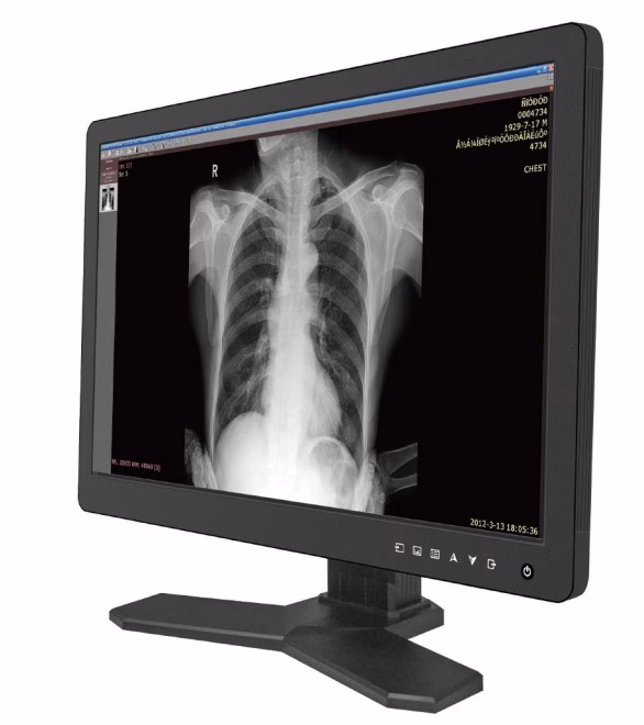 Reshin MD26C – Medizinischer Befundmonitor